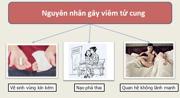 Nguyên nhân dẫn đến viêm tử cung 